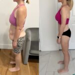 Masaż brzucha urządzeniem CelluMagia – efekt po domowym masażu