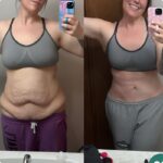 Użycie CelluMagia na brzuchu – opinia użytkowniczki