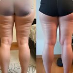 CelluMagia na nogach – opinia użytkowniczki