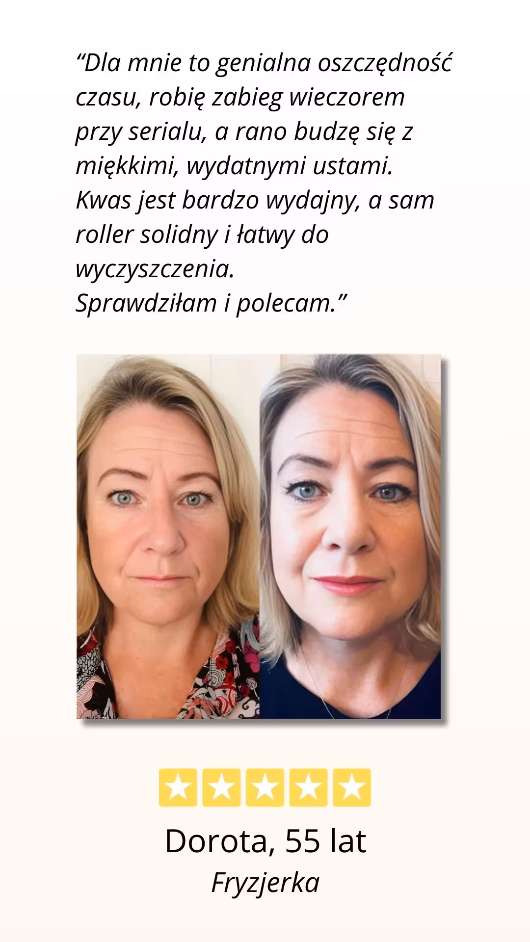 CelluRevital - pozytywna opinia użytkowniczki, efekt przed i po