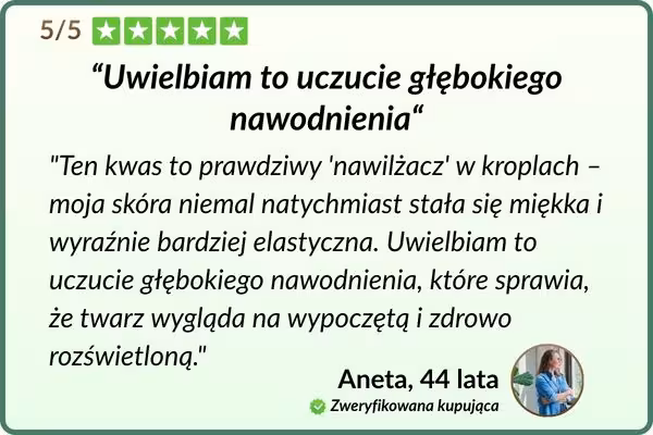 Kwas hialuronowy 3% pozytywna opinia użytkowniczki