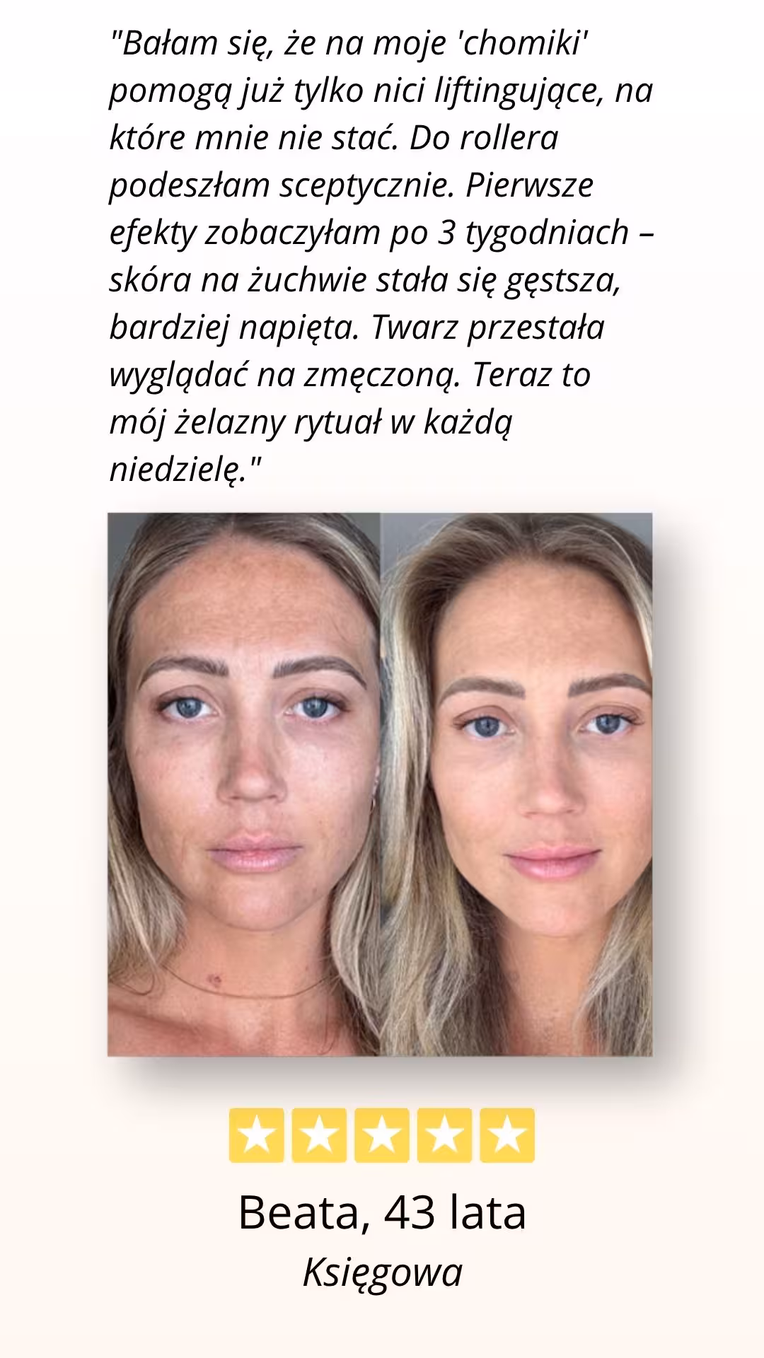 CelluRevital opinia zadowolonwj użytkowniczki