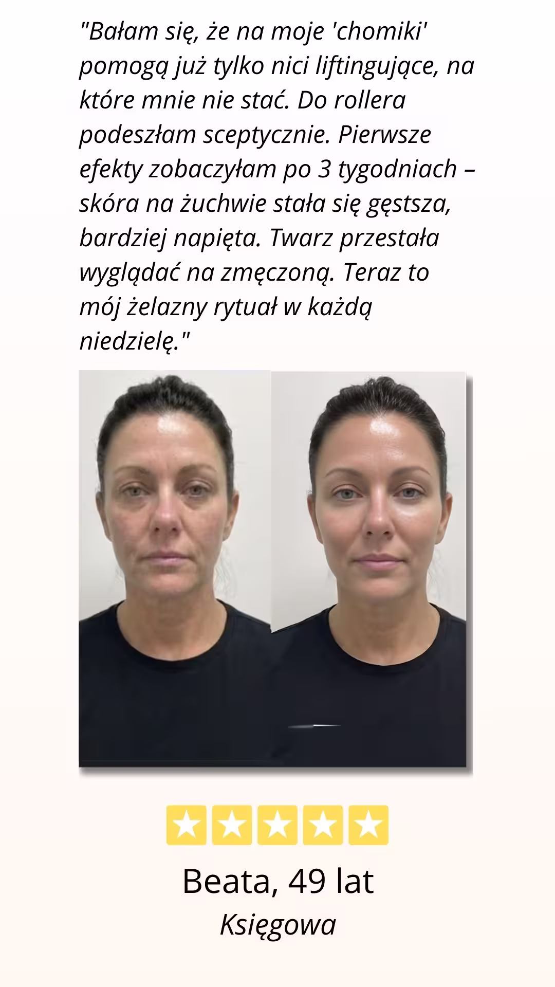 CelluRevital - pozytywna opinia użytkowniczki, efekt przed i po