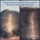 CelluRevital - efekty przed i po