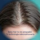 CelluRevital - odwraca łysienie, tworzy baby hair
