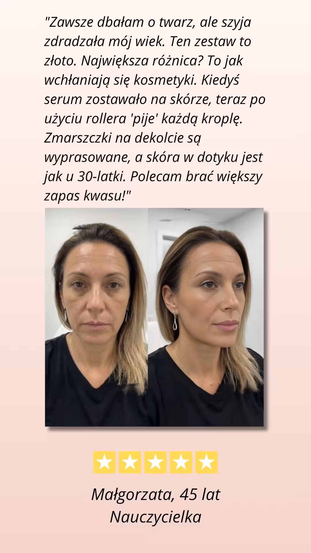 CelluRevital opinia zadowolonwj użytkowniczki