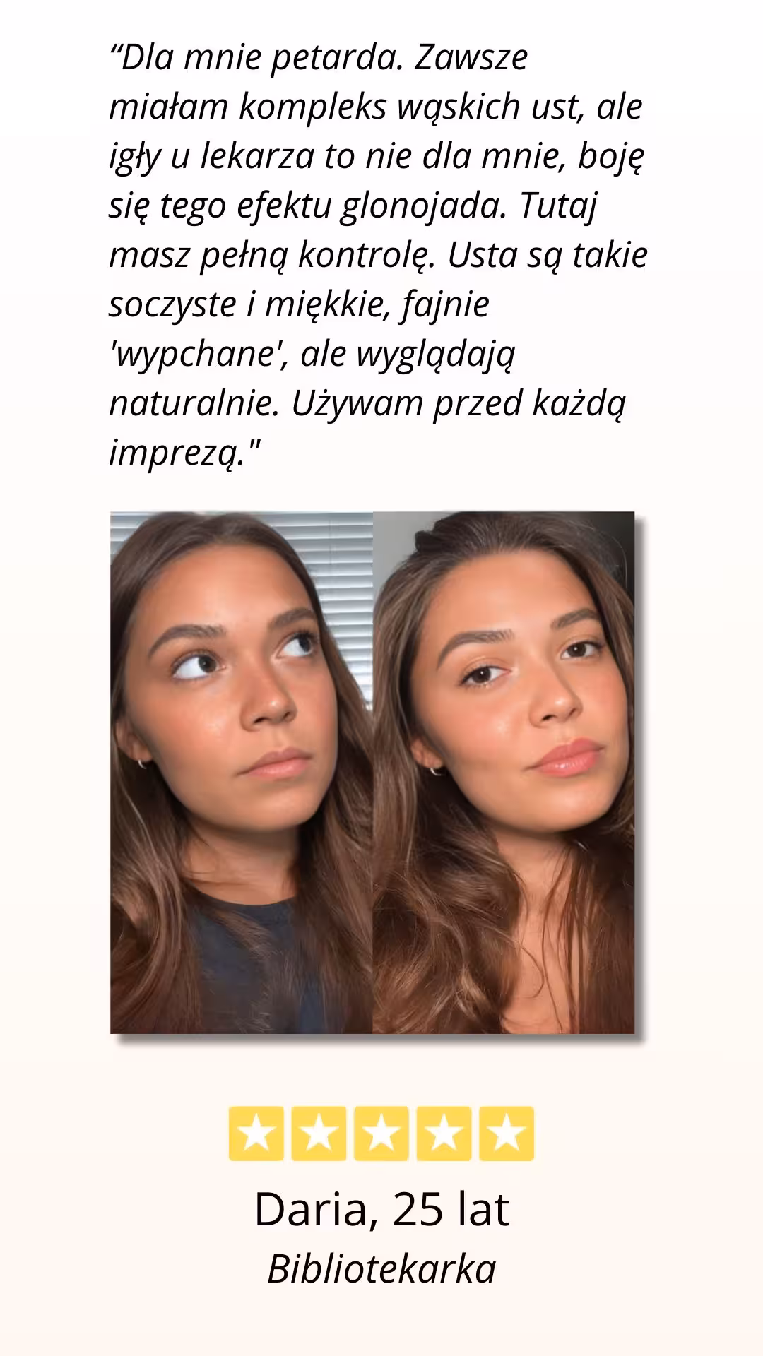 CelluRevital - pozytywna opinia użytkowniczki, efekt przed i po