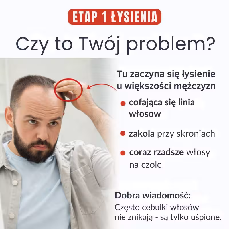 Jak zatrzymać wypadanie włosów w domu (bez przeszczepu)