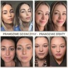 CelluRevital efekty przed i po