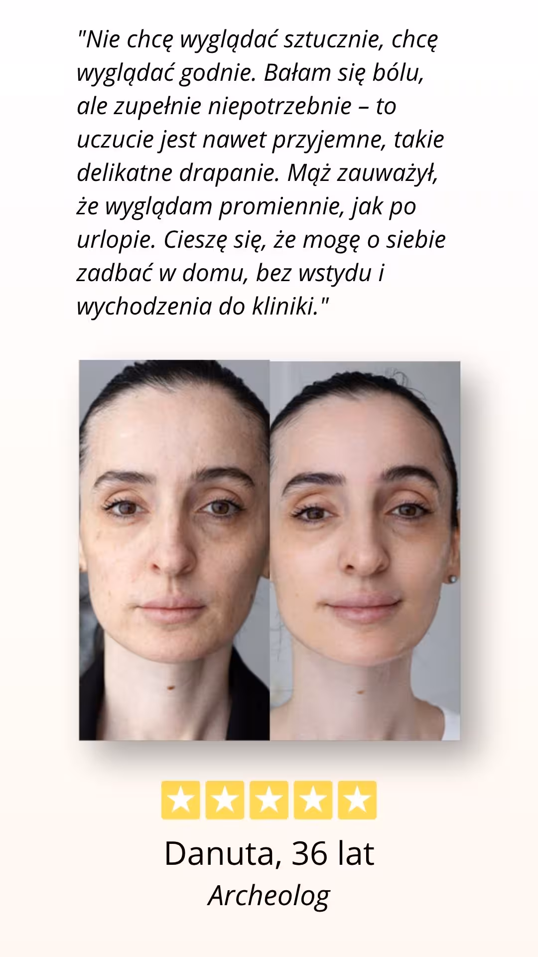 CelluRevital opinia zadowolonwj użytkowniczki