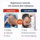 CelluRevital tańszy niż przeszczep