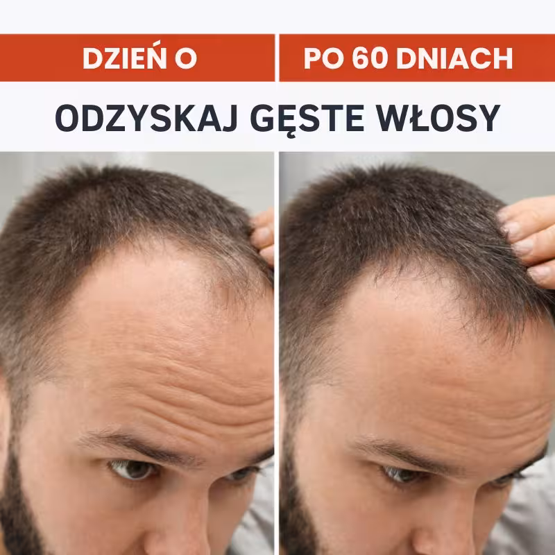 Dlaczego włosy wypadają? Najczęstsze przyczyny (i co z tym zrobić)