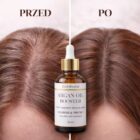 Argan Oil rezultaty przed i po