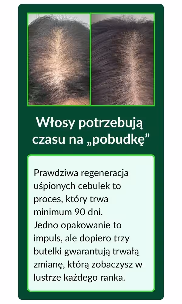 Epigenetyczne serum na wzrost wlosów zestaw Pełny Cykl