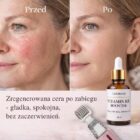 Witamina B5 na gładką cerę