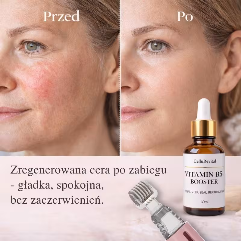 Witamina B5 na gładką cerę